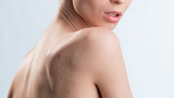 5. Keeps skin infection at bay