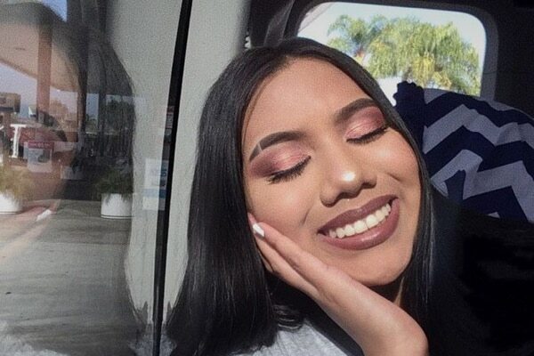 FAQ for Eyebrow Slit Trend