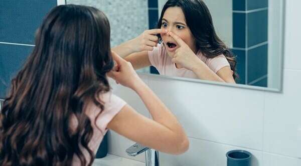 Easy Tips You Can Follow To Get Rid of Teenage Pimples