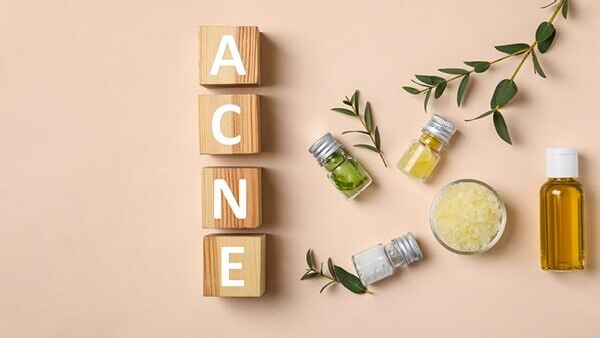 Easy Tips You Can Follow To Get Rid of Teenage Pimples
