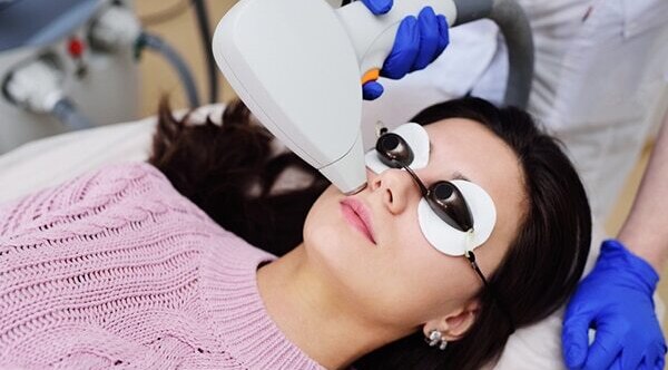 Frequently asked questions about upper lip hair removal