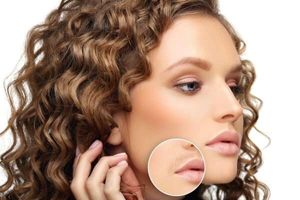 Frequently asked questions about upper lip hair removal