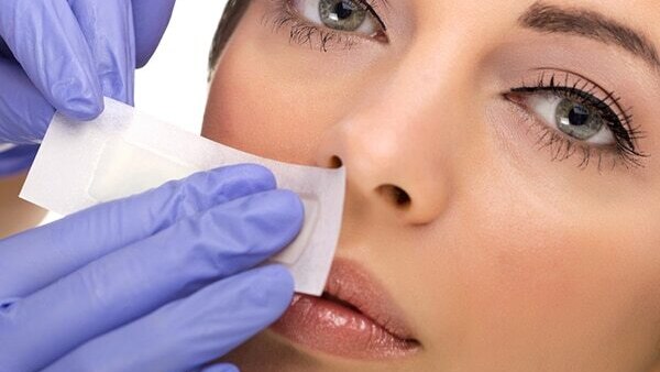 Frequently asked questions about upper lip hair removal