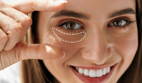 Quick And Effective Ways To Erase Dark Undereye Circles