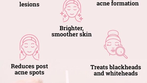 Are at-home chemical peels safe?