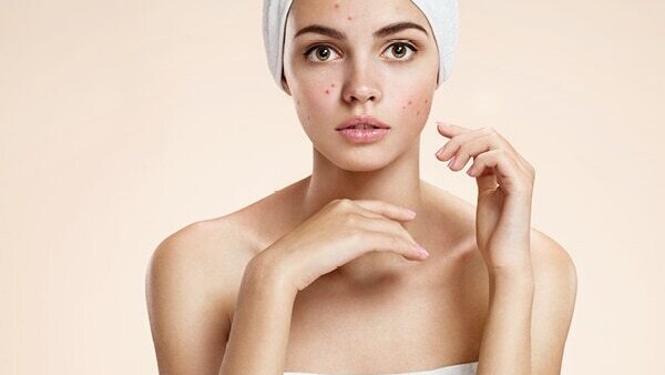 Are at-home chemical peels safe?