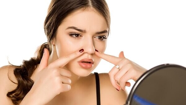 Are at-home chemical peels safe?