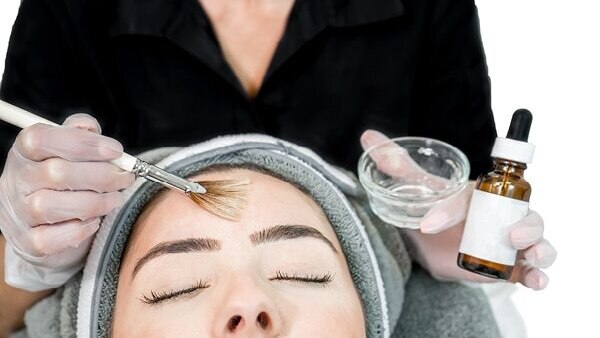 Are at-home chemical peels safe?
