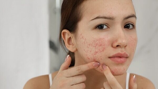 Do serums help with these scars?
