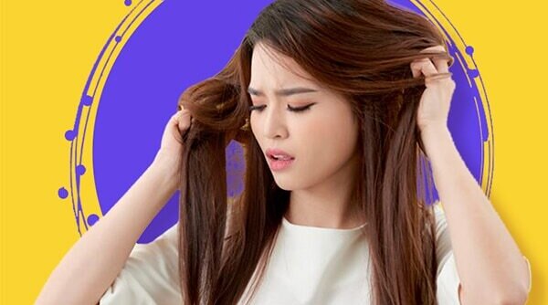 Lesser Known Reasons For Dandruff That We Bet You Didn’t Know About