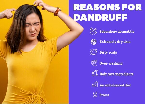 FAQs about the reasons for dandruff