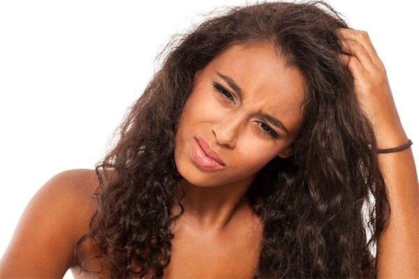 FAQs about the reasons for dandruff