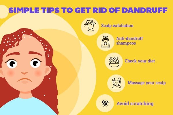 FAQs about the reasons for dandruff