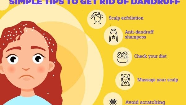 FAQs about the reasons for dandruff