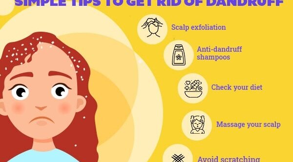 FAQs about the reasons for dandruff