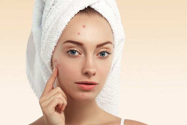 Frequently asked questions about using ice on the face
