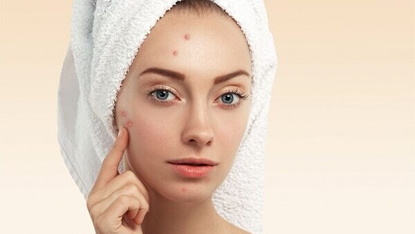 Frequently asked questions about using ice on the face