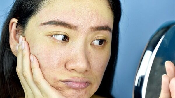 Frequently asked questions about using ice on the face