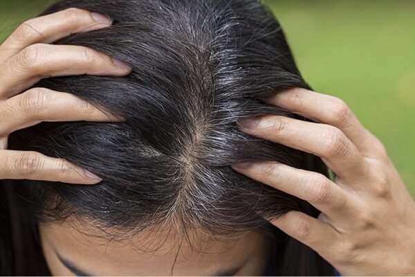 FAQs about folic acid for hair