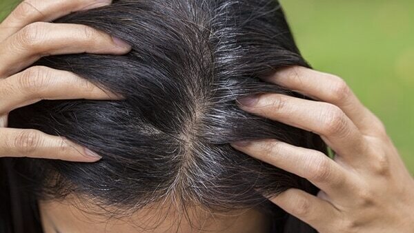 FAQs about folic acid for hair