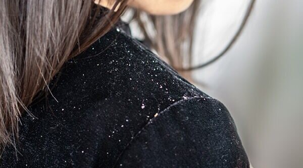 An Expert’s Guide To Proper Seborrheic Dermatitis Treatment