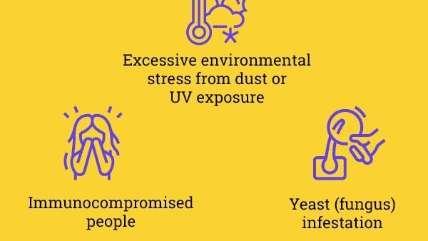 FAQs about seborrheic dermatitis
