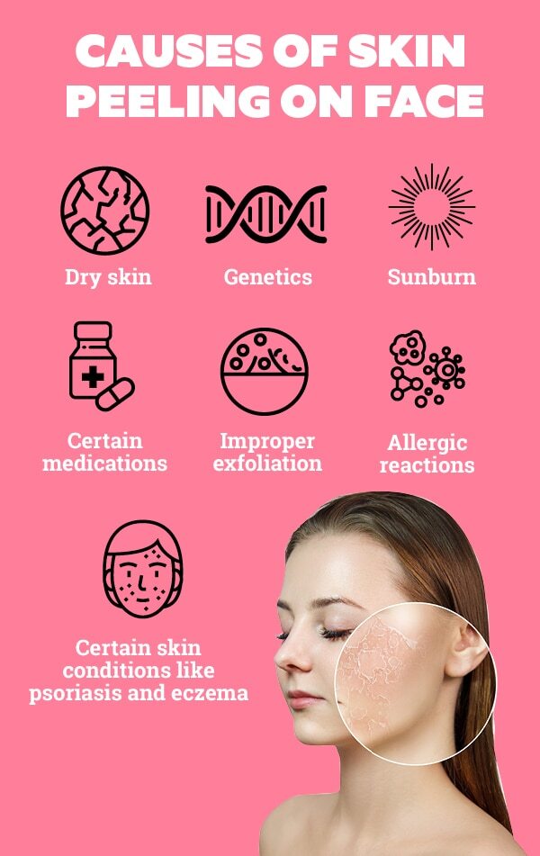 FAQs about skin peeling on face
