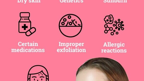 FAQs about skin peeling on face
