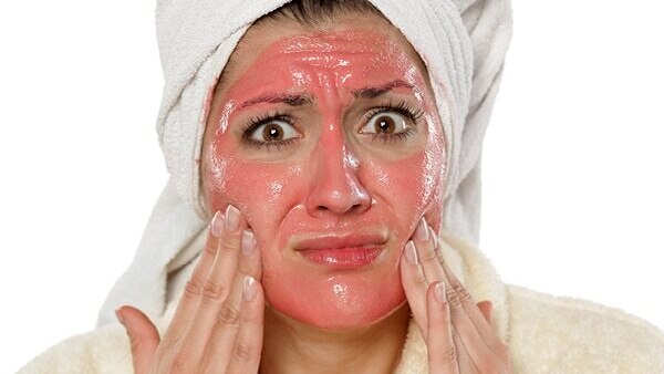 FAQs about skin peeling on face
