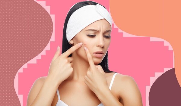 Heat Boils? Here's How To Calm Your Skin In The Hotter Months