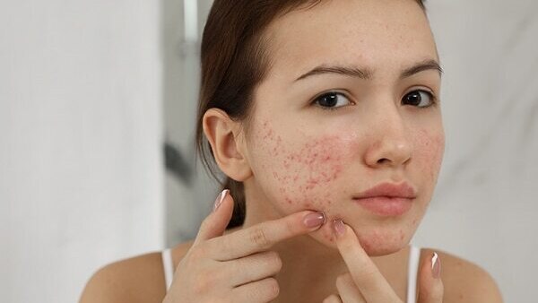 Can I use salicylic acid every day?