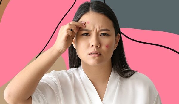 Is Vitamin E Good For Acne: A Dermatologist Reveals The Answer!