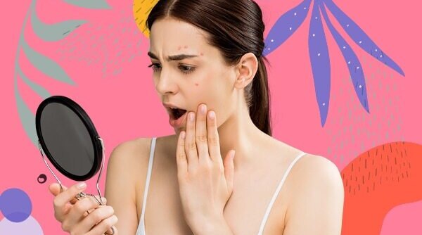 All About Fungal Acne: Causes, Symptoms And Treatment