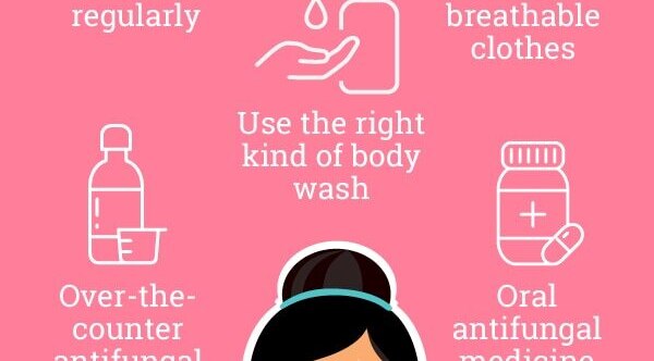 FAQs about fungal acne
