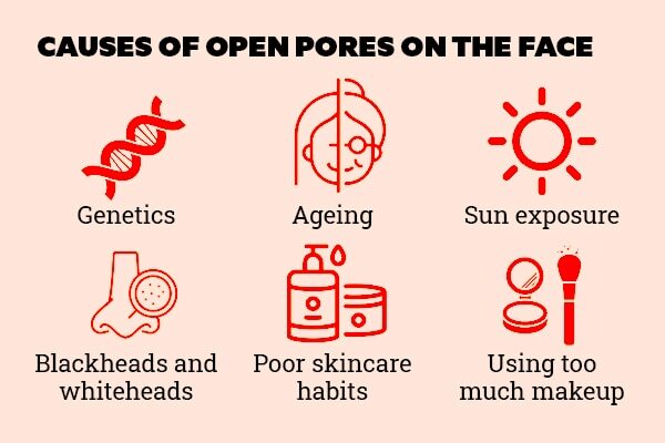 FAQs about open pores on face