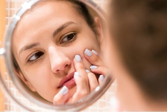 FAQs about open pores on face