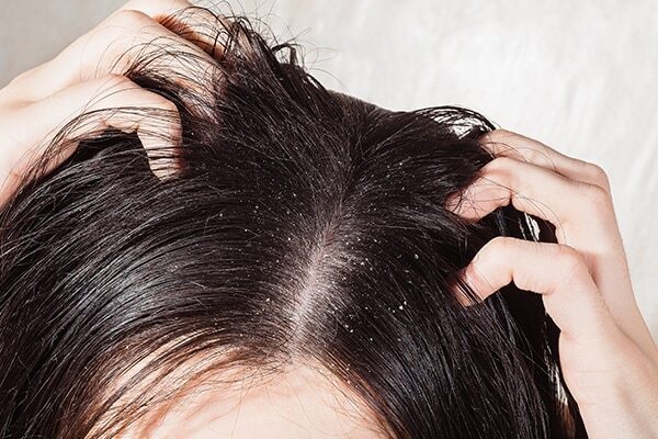 Prevents hair ageing