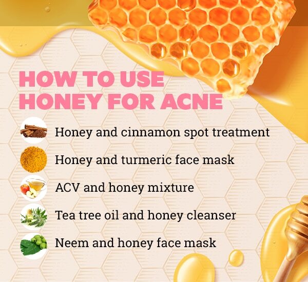 FAQs about honey for pimples