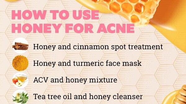 FAQs about honey for pimples