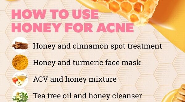 FAQs about honey for pimples