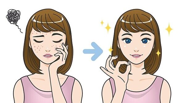11 Home Remedies To Tackle Skin Pigmentation Around The Mouth