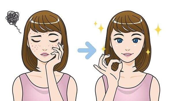 11 Home Remedies To Tackle Skin Pigmentation Around The Mouth