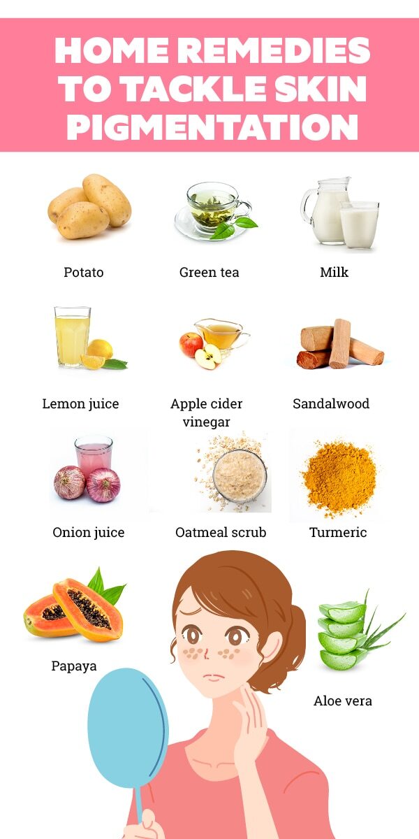 FAQs about skin pigmentation