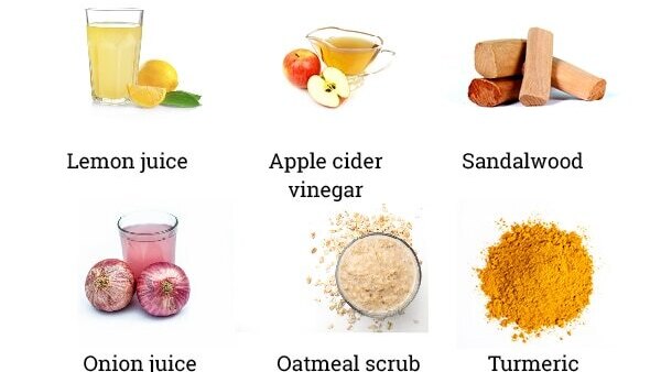 FAQs about skin pigmentation