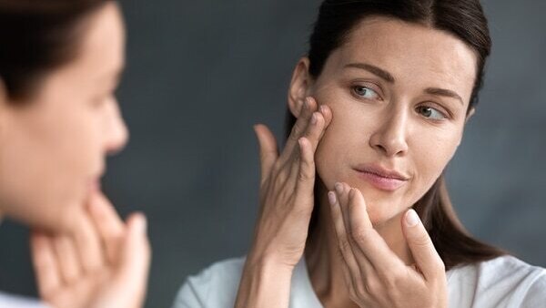 FAQs about skin pigmentation