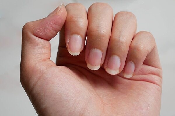 Solves nail problems