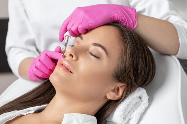 Treating smile lines at home