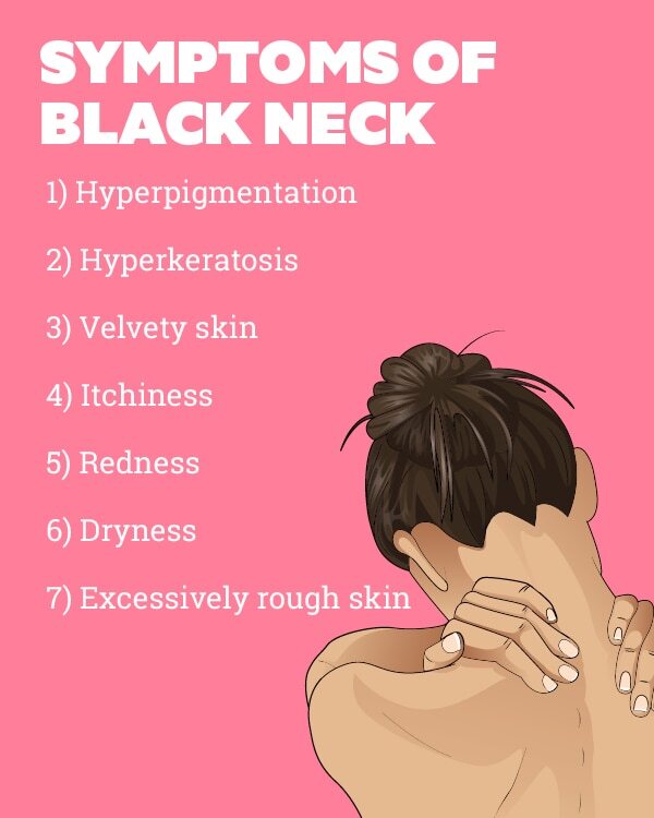 FAQs about black neck