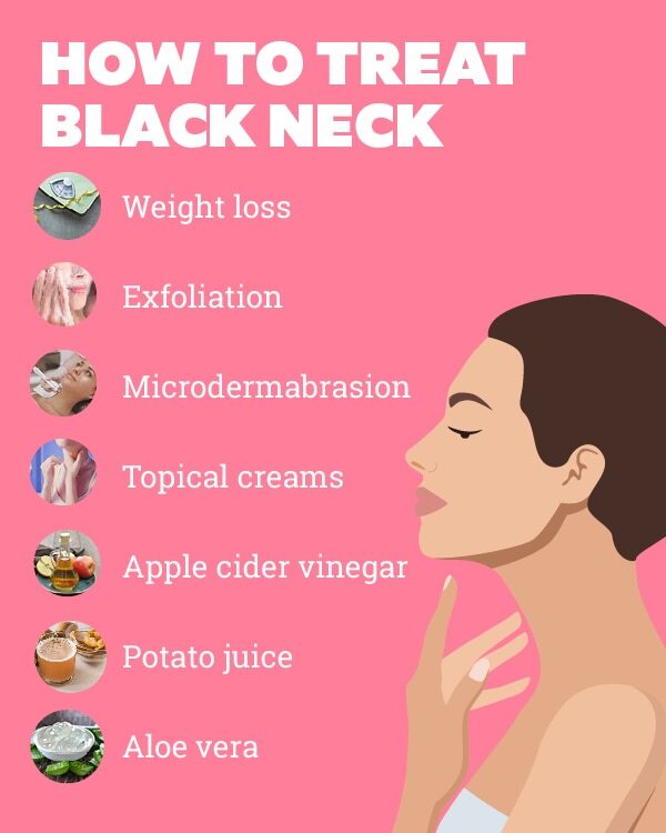 FAQs about black neck