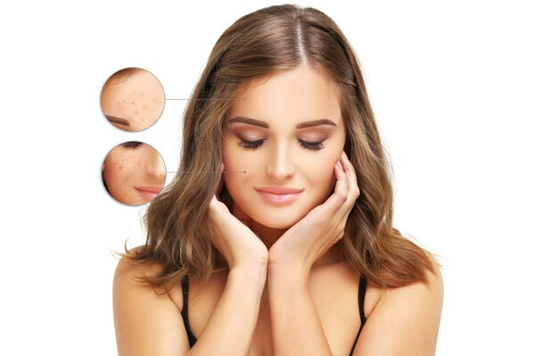 Swear by the Lakmé Skin Gloss Gel Creme